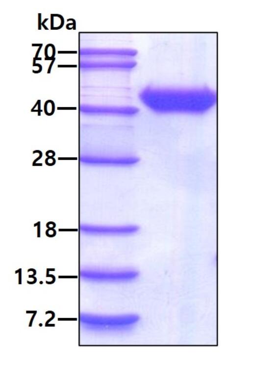 3 μg by SDS-PAGE under reducing condition and visualized by coomassie blue stain